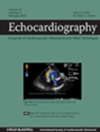 ECHOCARDIOGRAPHY-A JOURNAL OF CARDIOVASCULAR ULTRASOUND AND ALLIED TECHNIQUES杂志封面
